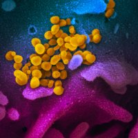 Krāšņi foto: koronavīruss varenā mikroskopu palielinājumā