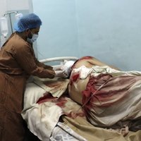 СМИ сообщают о гибели не менее 10 мирных жителей при авиаударе США в Кабуле