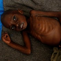 ANO: 400 tūkstoši bērnu Kongo DR draud nomirt bada nāvē