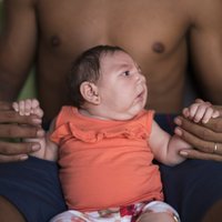 Опасная эпидемия: в Южной Америке рождаются младенцы с очень маленькой головой