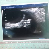 Jautrs ultrasonogrāfijas uzņēmums - gaidāmais mazulis vecākiem signalizē, ka 'viss būs labi'