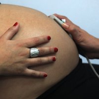 В Британии разрешат эмбрионы с ДНК трех человек