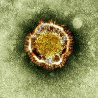 Число заболевших коронавирусом может быть занижено в десятки раз