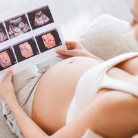Зачем делать УЗИ на разных сроках беременности: комментарий акушерки