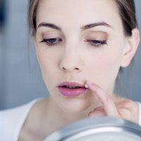 Как победить простуду на губах: советы дерматолога