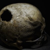 Strīdas par caurumu pirms 3400 gadiem apbedīta vīrieša galvaskausā