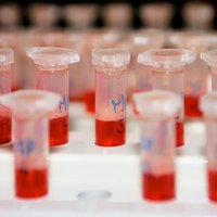 Profesore: Latvijā jau ir HIV epidēmija; nākamgad ārstēšanu apmaksās vairāk pacientiem