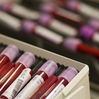 Asinsdonoru centrs turpmāk HIV un citus vīrusus asinīs meklēs vēl rūpīgāk