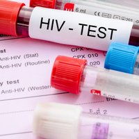 Объединение HIV.LV: надо объявить чрезвычайное положение из-за распространения ВИЧ и СПИД