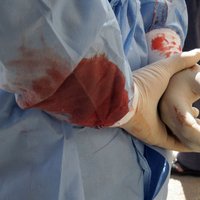 Sagrautā medicīnas sistēma Sīrijā: zobārsti operē un farmaceiti ārstē