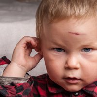 Что важно знать о детском травматизме: хирург отвечает на 6 вопросов