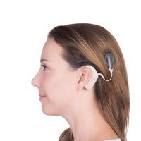 Kohleārie implanti – nedzirdīgo iespēja dzirdēt