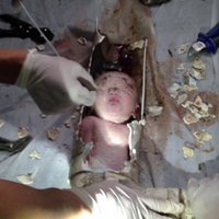 Похороненный заживо младенец выжил после восьми часов пребывания под землей