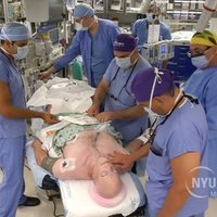 Проведена самая масштабная в мире операция по пересадке нового лица