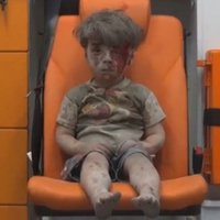 Sīrijā uzlidojumā izdzīvojuša zēna video aizkustina cilvēkus visā pasaulē
