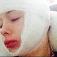 ФОТО: На Барби из Одессы напали и избили недоброжелатели