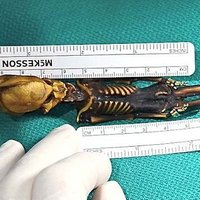 Ученые раскрыли загадку мумии "инопланетянина" из Чили